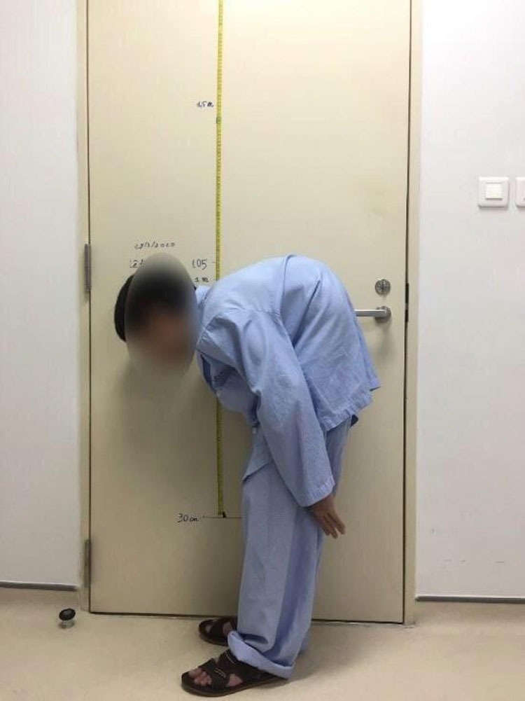 Hình ảnh hưởng phẫu thuẫn nắn chỉnh cột sống của bệnh nhân L.Đ.Q (44 tuổi, ở TP. Bắc Ninh).